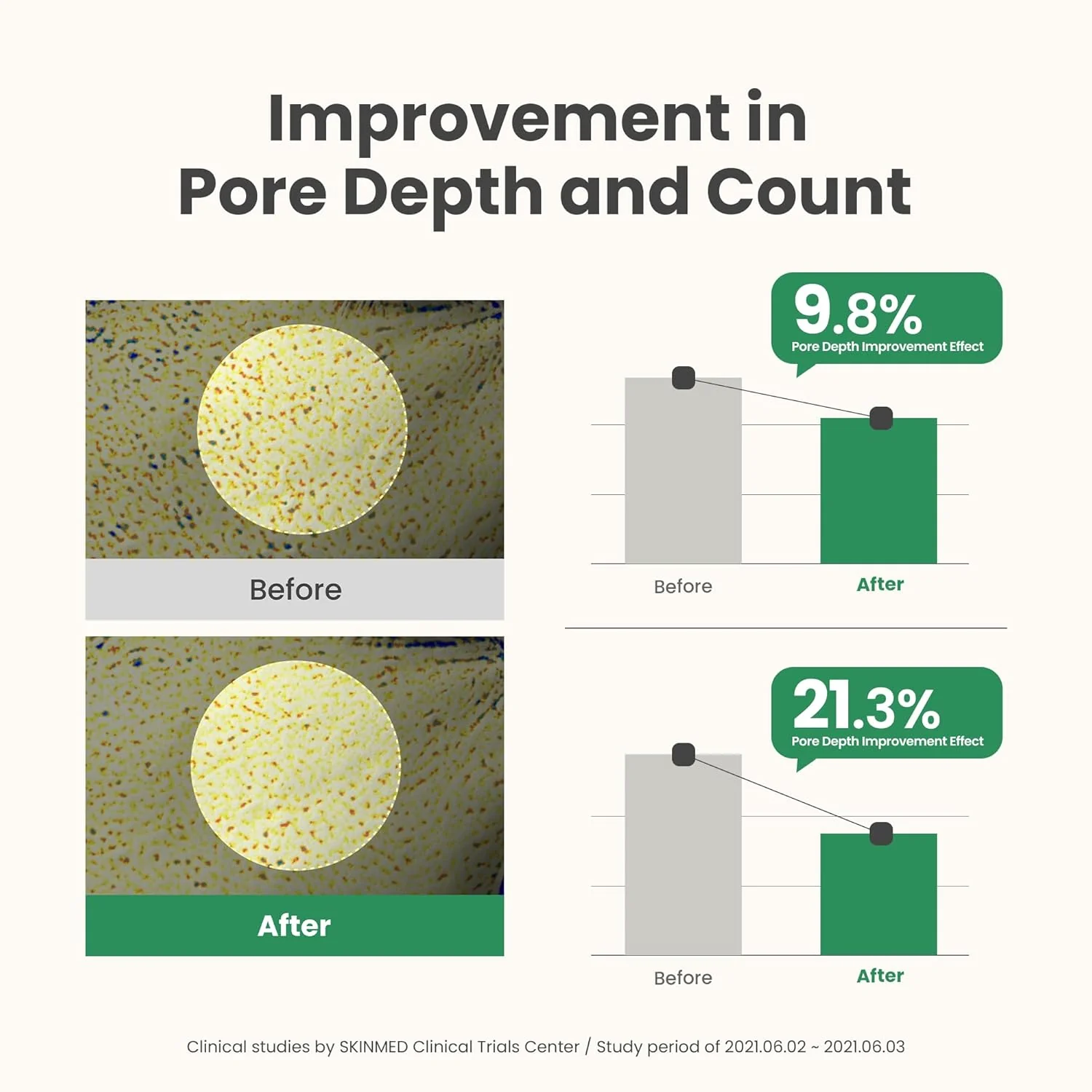 AXIS-Y Mugwort Pore Clarifying Wash Off Pack - Image 6