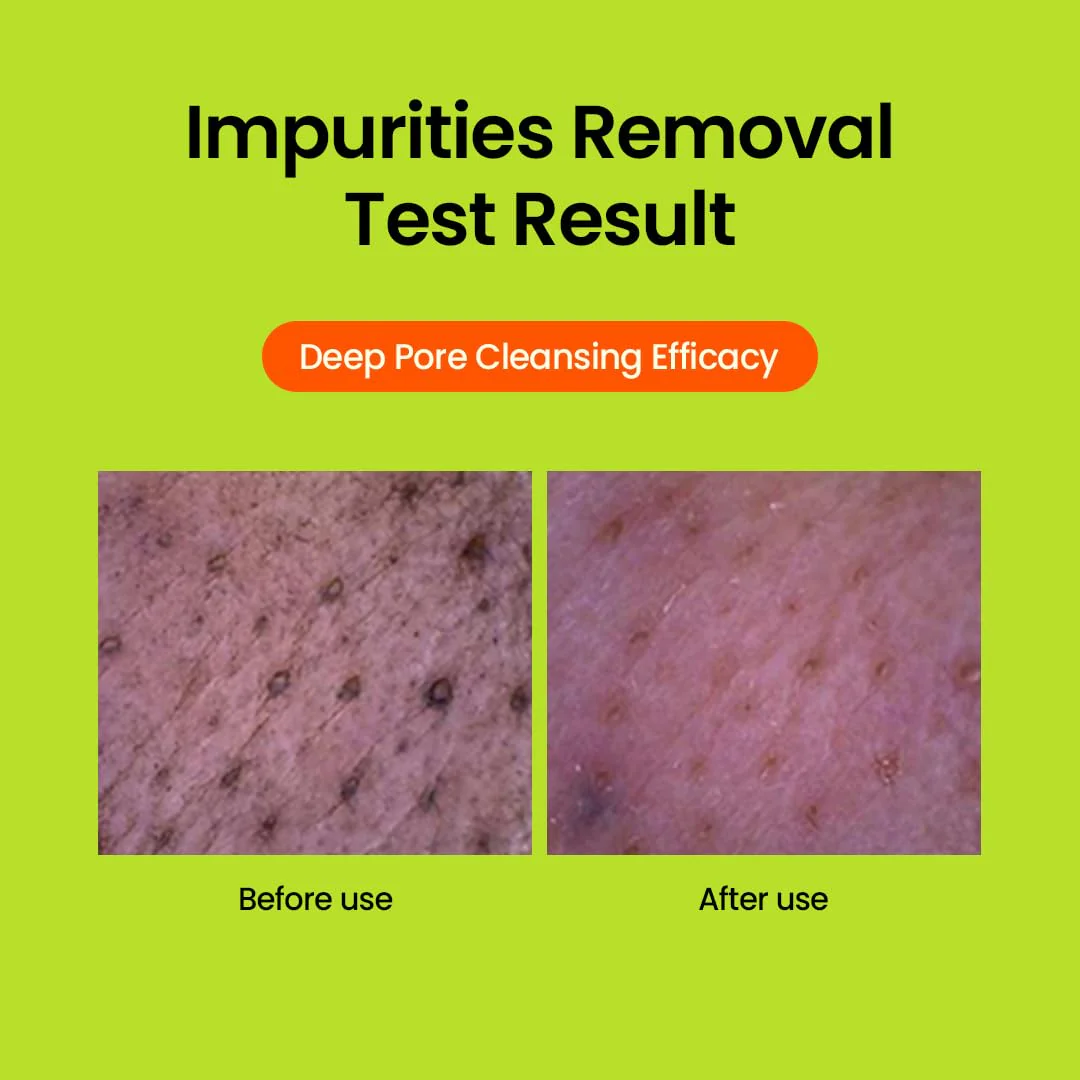 beplain Mung Bean Cleansing Foam 80ml - Image 6