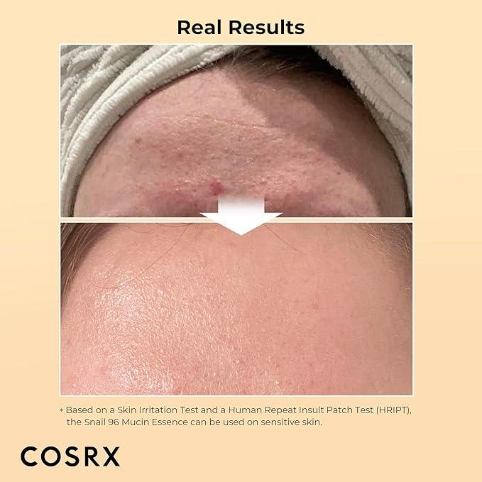 COSRX Advanced Snail 96 Mucin Power Essence 100ml - Image 4