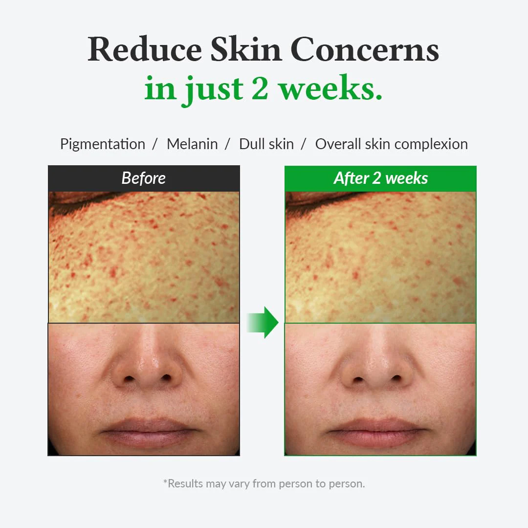 Dr.Althea Gentle Vitamin C Serum 30ml - Image 5