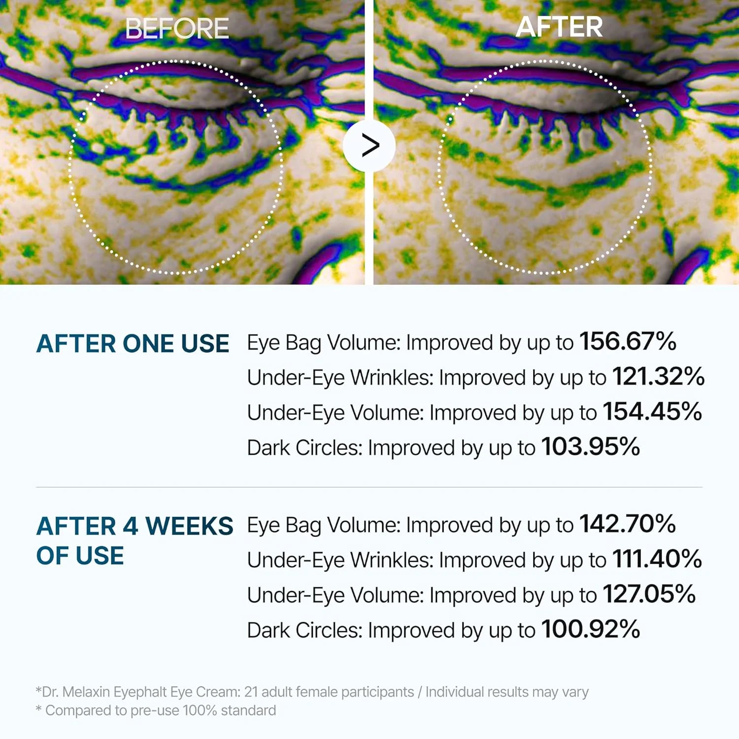 Dr.Melaxin Eyephalt Eyecream for Eyebags 10ml - Image 8