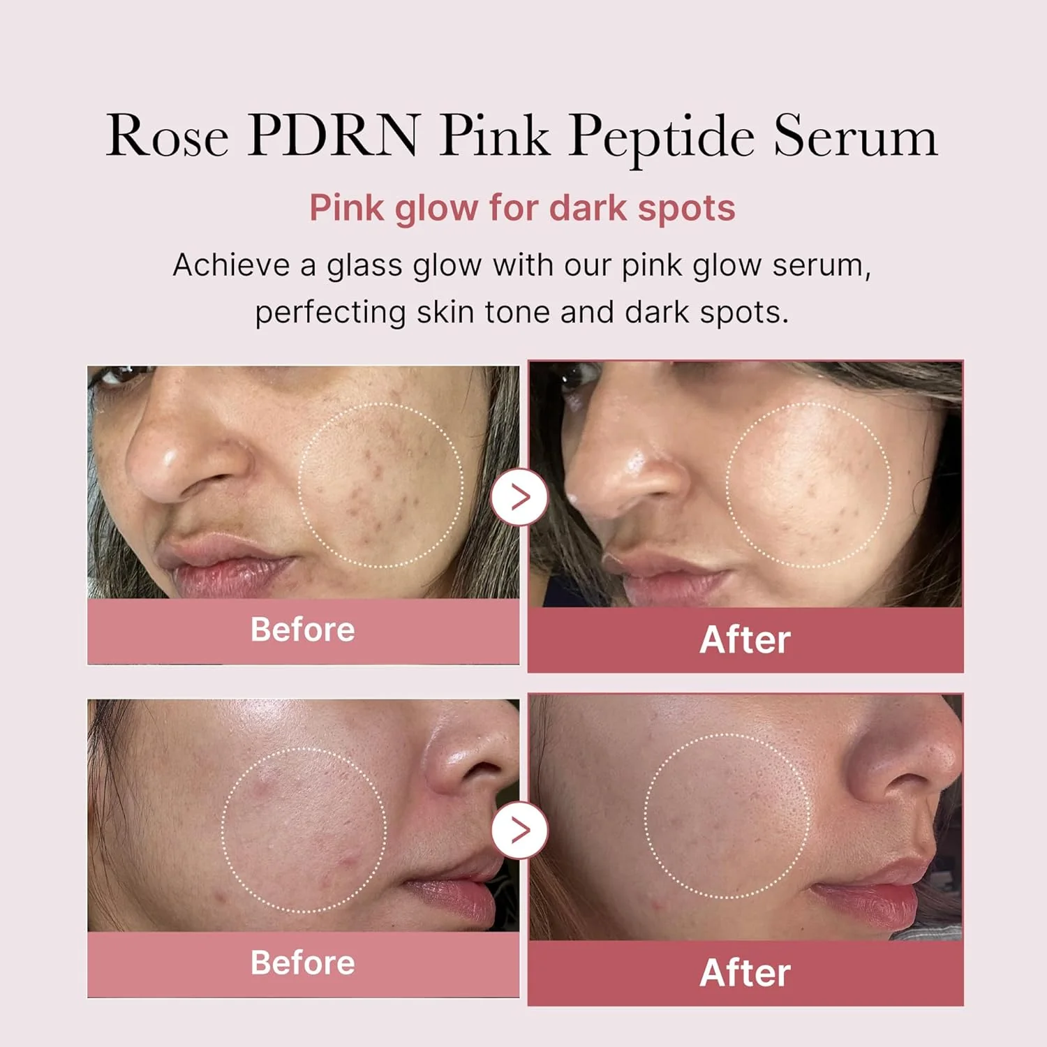 Medicube PDRN Pink Peptide Serum 30ml - Image 2