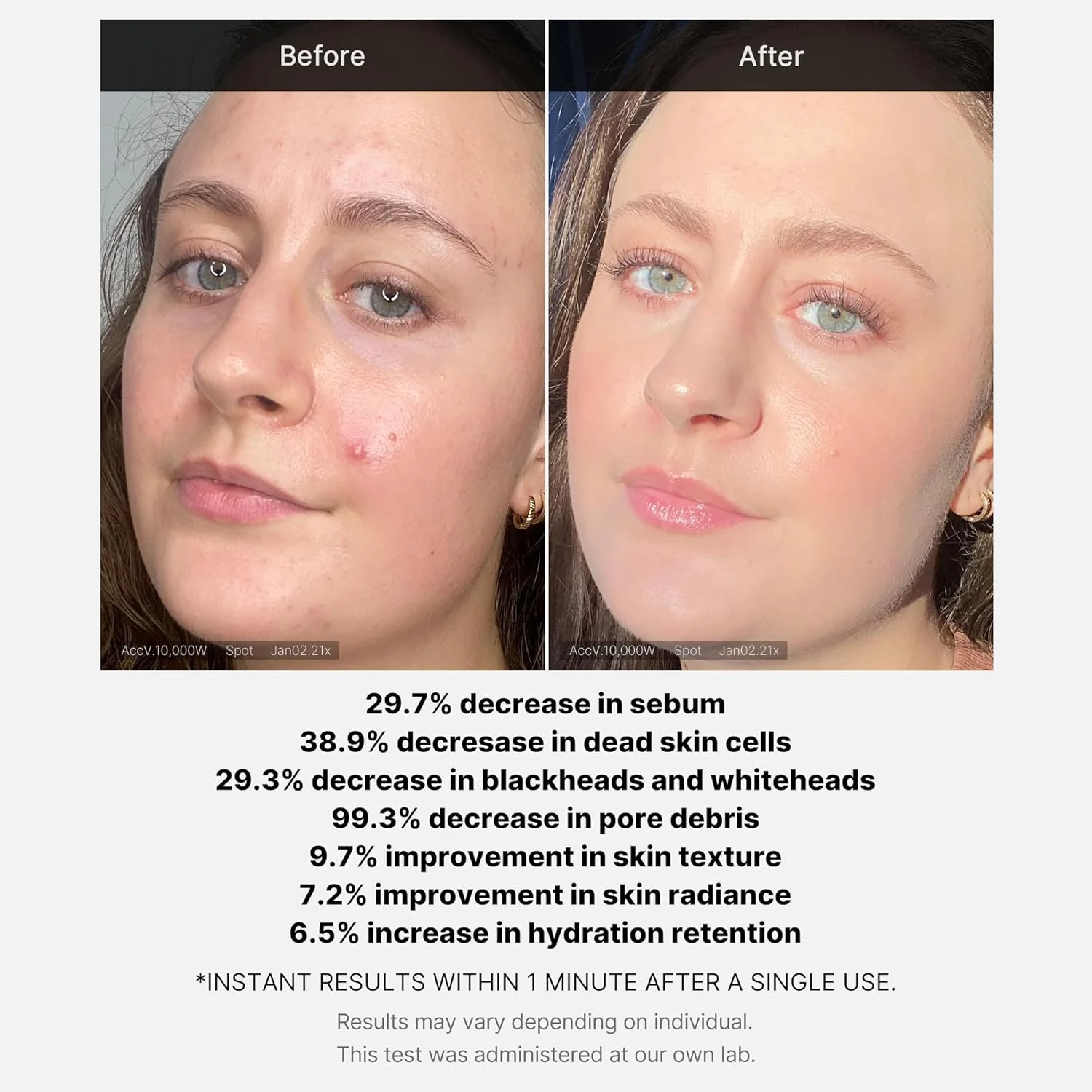 Medicube Red Acne Succinic Acid Peel 40ml - Image 4