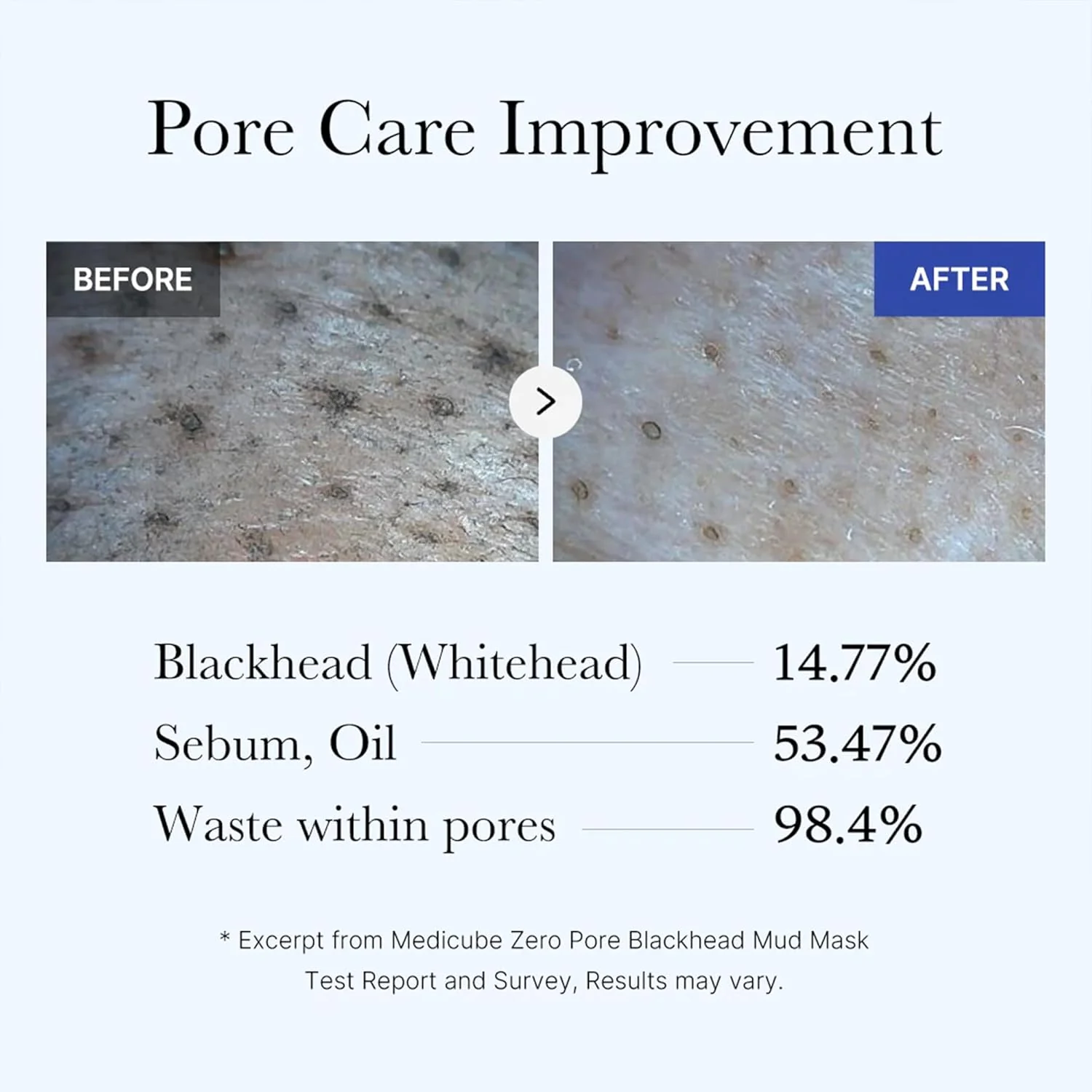 Medicube Zero Pore Blackhead Mud Mask 100g - Image 5