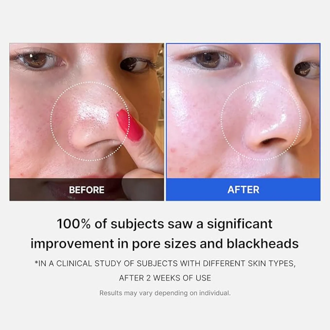 Medicube Zero Pore Pad 2.0 70 Pads - Image 5