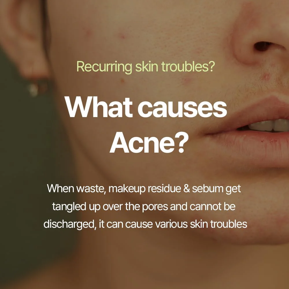 Pyunkang Yul Calming Acne Cleansing Foam 100ml - Image 4