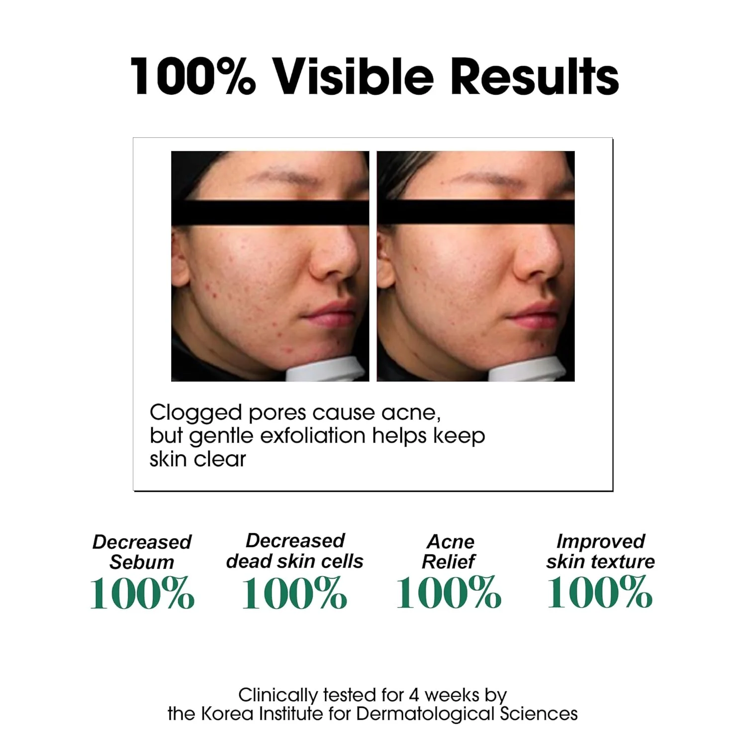SOME BY MI AHA BHA PHA 30 Days Miracle Toner - Image 5