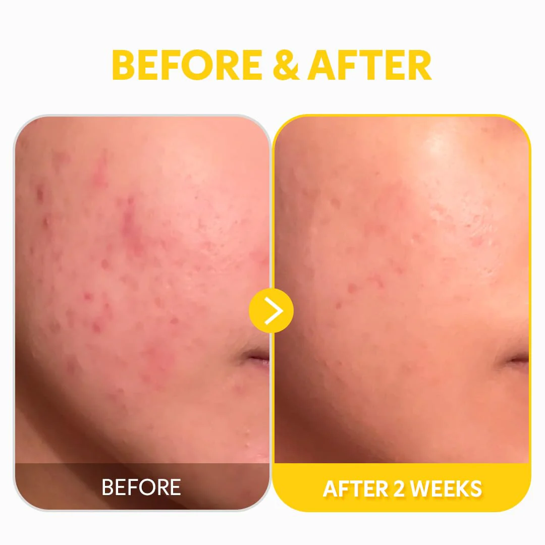 TIRTIR Pure Vitamin C 24% Serum 30ml - Image 7