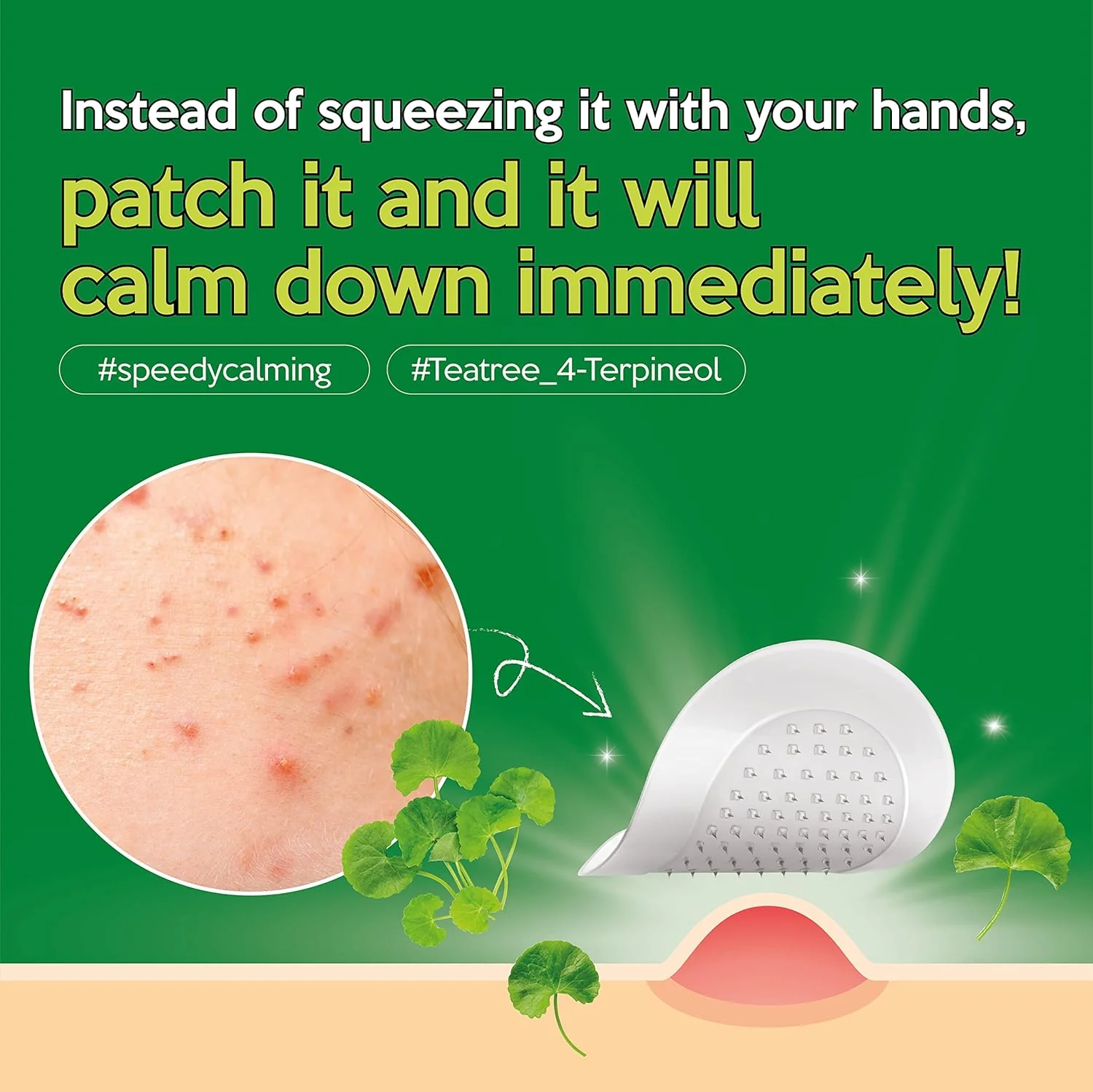 Troubless Micro-Point Patch - Image 3