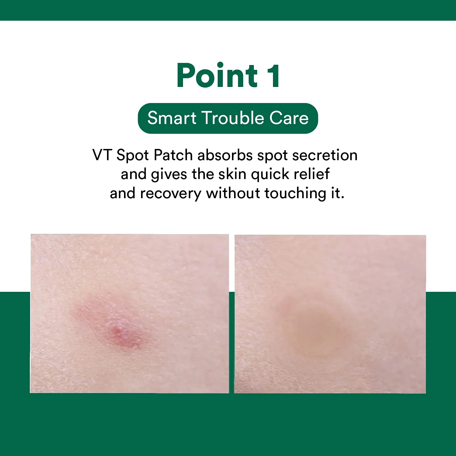 VT Spot Patch 48ea - Image 3